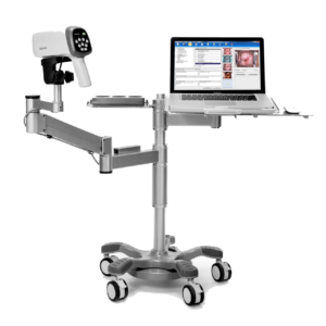 VIDEOCOLPOSCOPIO EDAN C6A
