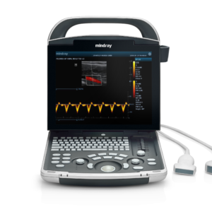 ECOGRAFO MINDRAY DP 30 POWER