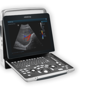 ECÓGRAFO MINDRAY Z60