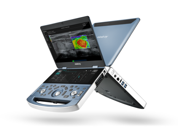 ECÓGRAFO MINDRAY MX7 - Imagen 3